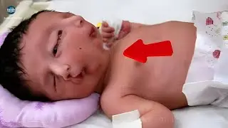 ¡12 niños extraordinarios con características y habilidades asombrosas! | Equipo Yoyo Media