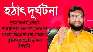 কিছু হটাৎ দূর্ঘটনার হোমিও ঔষধ | বায়োকেমিক ঔষধ | some accidentals homeopathy medicine