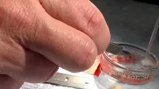 Preparation of a cardiac slice