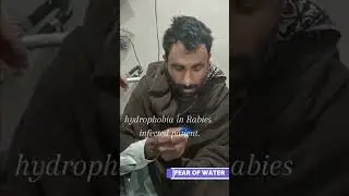 Rabies patient real video #rabies #rabiespatient #fearofgodessentials