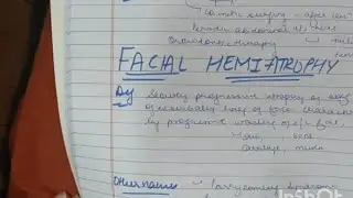 Facial Hemiatrophy Oral Pathology