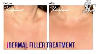 Cosmetic Skin Clinic | Skin Treatment Beaconsfield - London City Skin Clinic