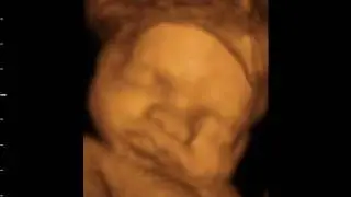 30 weeks Beautiful 3D 4D baby bonding scan