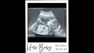 Our hearts are full and the secret ends today 💕💙 Akhila & Ajil 💕💙 Gender Reveal