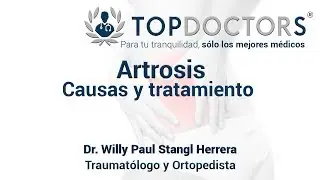 &iquest;Qu&eacute; es la artrosis? Causas y tratamiento