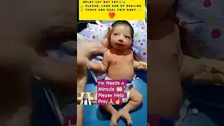 🙏 Urgent Prayer for Healing | Please Join Us in Faith ❤️ #baby  #viral  #shorts