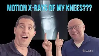 I Used Motion X-Rays On My Knees