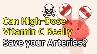 Can High-Dose Vitamin C Really Save Your Arteries?
