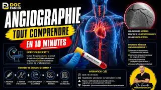 Angiographie