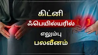 கிட்னி ஃபெயில்யரில் எலும்பு வலி ஏன்? | Bone damage due to kidney disease | Dr Puru Dhawan