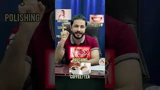 #teethwhitening #teethcleaning #teethproblems #explained #explainedinurdu