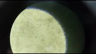 microfilaria #worm #mbbs #pathology #neetpg