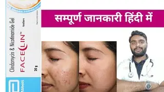 Faceclin gel | Faceclin Gel&nbsp;uses in Hindi | Faceclin gel uses | Faceclin Gel&nbsp;benefits