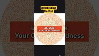 I Tried A Color Blind Test For The 1st Time ✅#colorblind #colorblindtest #colorvision #ssc #sscgd