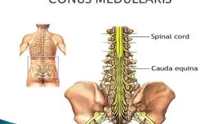 Intercostal Nerves and Conus Medullaris  www.ezqmeceu.com