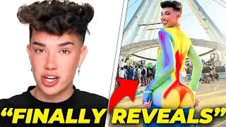 James Charles REVEALS his surgery's!
