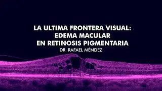 La &uacute;ltima frontera visual: Edema macular en retinosis pigmentaria - Dr. Rafael M&eacute;ndez