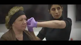 Dermal Filler Training Course Video Dr Tapan Patel
