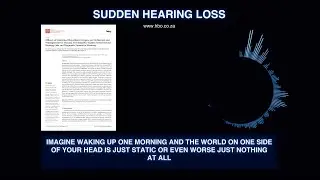 Sudden Hearing Loss - Deep Dive