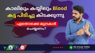 കാലിലും കയ്യിലും Blood കട്ട പിടിച്ചു കിടക്കുന്നു? | Live Q&A | Anoop Patter