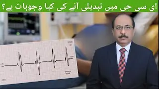 Are ECG Changes in Angina a Warning Sign for Heart Attack