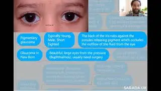 Prevent the most dangerous & common Blindness. Glaucoma explained by a Doctor: How is it treated?
