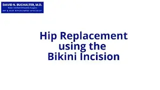 Hip Replacement using the Bikini Incision