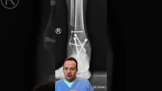 AMAZING HE CAN STILL WALK! 😱#shorts