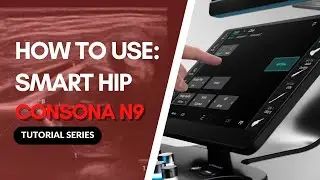 Mindray Consona N9 - Automatic Pediatric Hip Measurement Demo