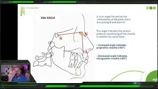 13- AFK weekly news letter  - Important orthodontic questions