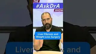 &ldquo;If I have #Liver #Fibrosis, can I get #WeightLoss surgery?&rdquo; #AskDrA #wls #wlscommunity #vsg