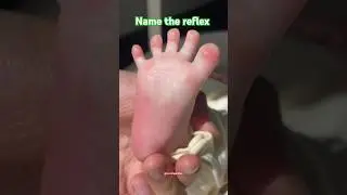 Babinski's Reflex #paediatric #neonates #nursingaddaa  #reflexes