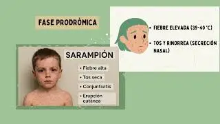PECHAKUCHA SARAMPION 404