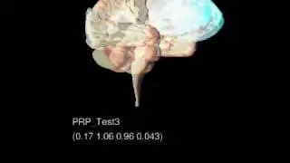 MindModeling@Home beta screensaver | 2.61