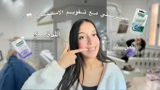تجريبتي مع تقويم الأسنان 🦷🪥إيجابيات وسلبيات + الثمن