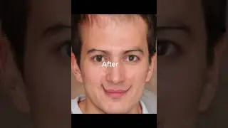 People before and after mental hospital