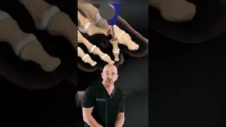 Bent Toes? You&rsquo;re Not Alone 🔨 #shorts