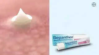 Regenera la piel desde las capas m&aacute;s profundas