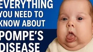 Everything You Need to Know About Pompe&rsquo;s Disease |