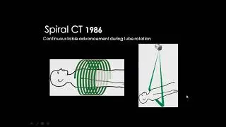 Pediatric chest imaging I DRE Prof  Mamdouh Mahfouz HD