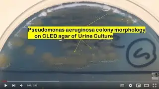 Pseudomonas aeruginosa growth on CLED agar of Urine Culture