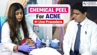 Chemical Peeling for Acne Scars | Live Procedure Step by Step | Glycolic Acid Mask | Dr. Ashish