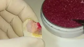 Gota #153 FUNDIÇÃO EM ODONTOLOGIA