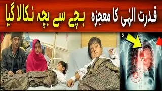 Unbelievable Case: Fetus in Fetu Surgery in Rahim Yar Khan