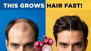 Just One Onion Can Regrow Your Hair FAST (No Chemicals Needed)