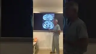 He Optimized Disease While Optimizing His Wealth Then Optimized His Health & Wealth!