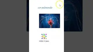 Anatomy Thorax 294 Cor Pulmonale Right Sided Heart failure chronic lung disease viva