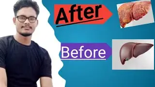 Adlive syrup kis kaam aata hai/ADLiVE SYRUP iN Hindi