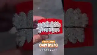 Oval cut honeymoon custom grillz