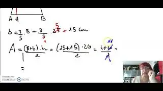 G2 5g area trapezio